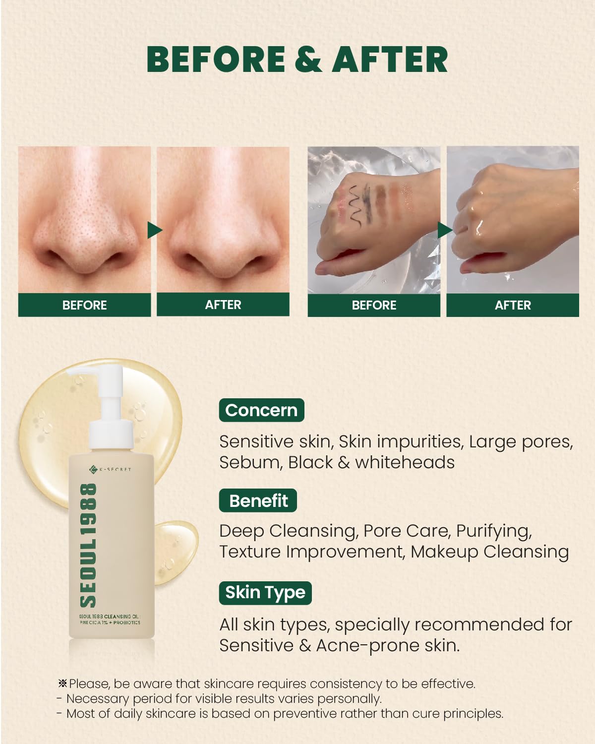 KSECRET - SEOUL 1988 Cleansing Oil : Pine Cica 1% + Probiotics