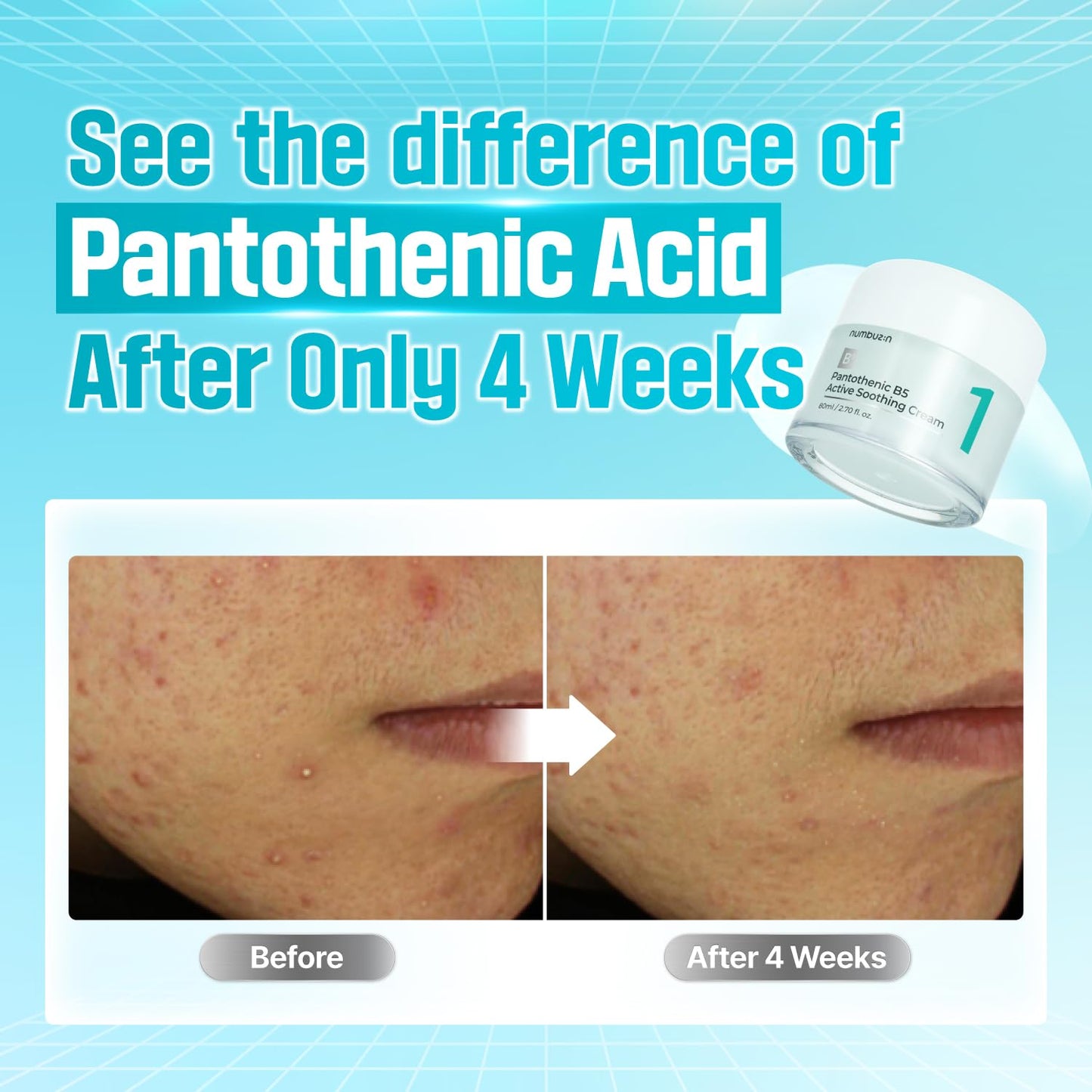 numbuzin - No.1 Pantothenic B5 Active Soothing Cream - Crème apaisante