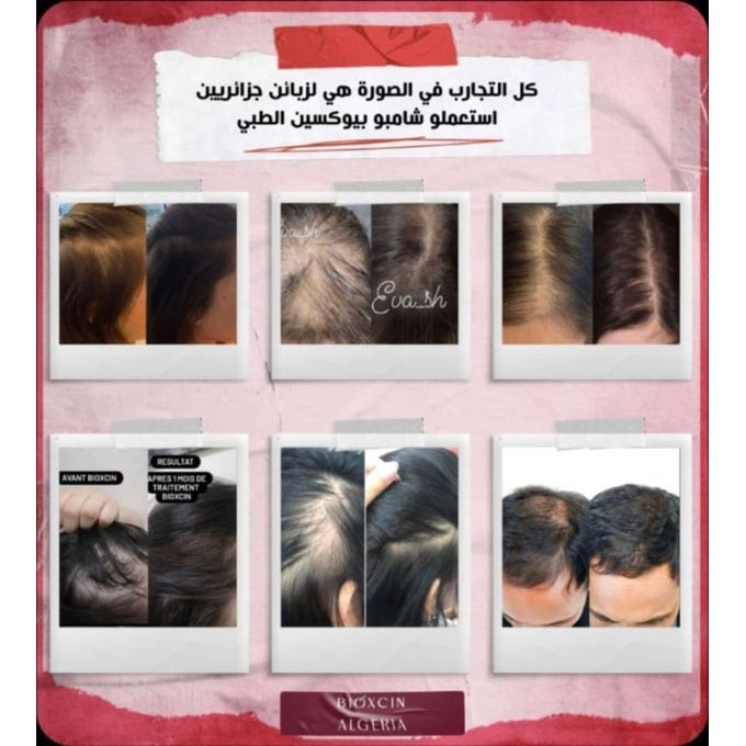 Bioxcin  shampooing anti chute