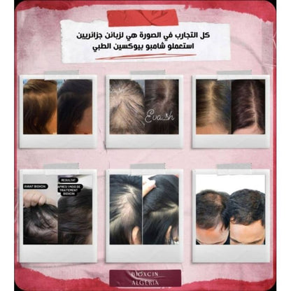 Bioxcin  shampooing anti chute