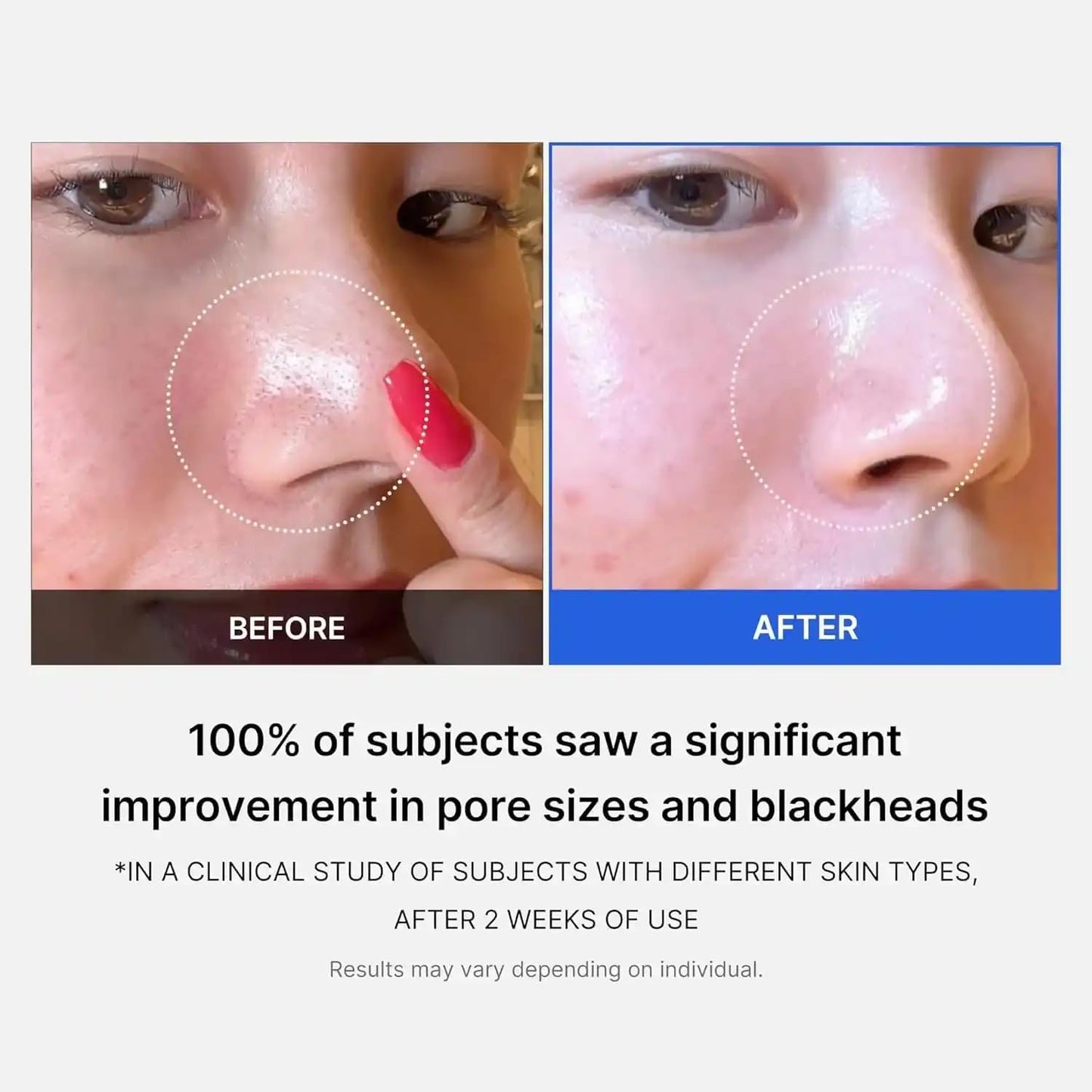 medicube - Zero Pore Pad 2.0 - Disques exfoliants anti-pores