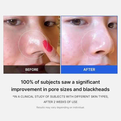 medicube - Zero Pore Pad 2.0 - Disques exfoliants anti-pores