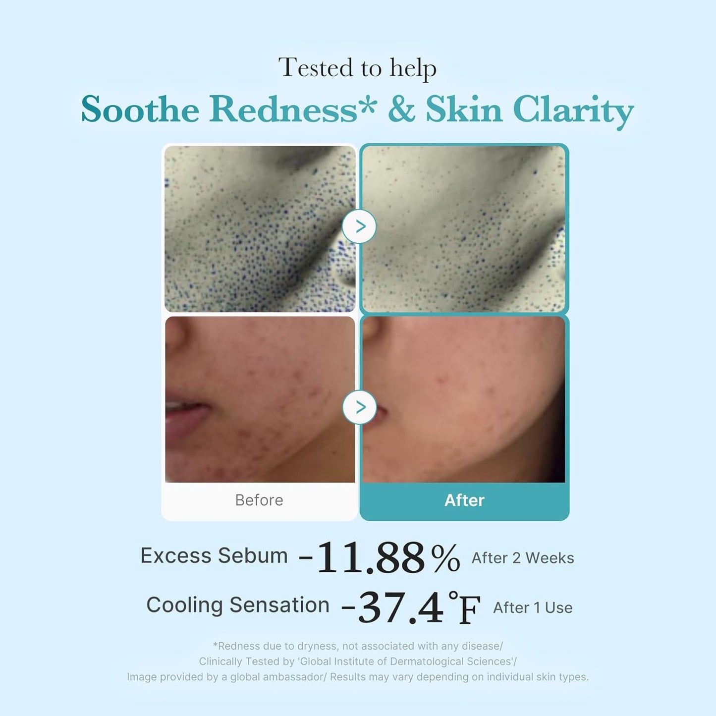 medicube - Azelaic Acid Niacinamide Clear Toner