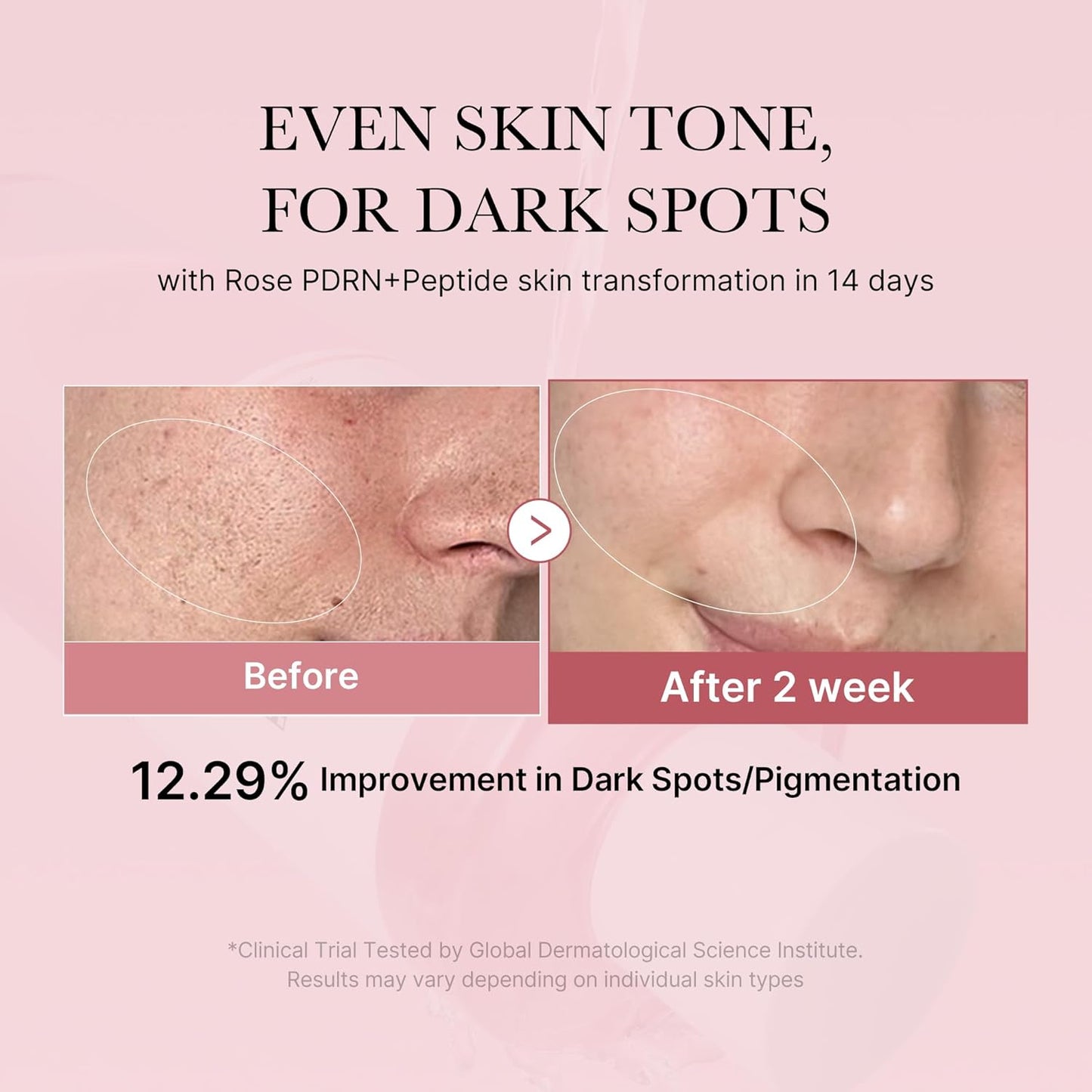 medicube - PDRN Pink Cica Soothing Toner