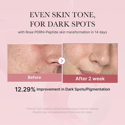 medicube - PDRN Pink Cica Soothing Toner