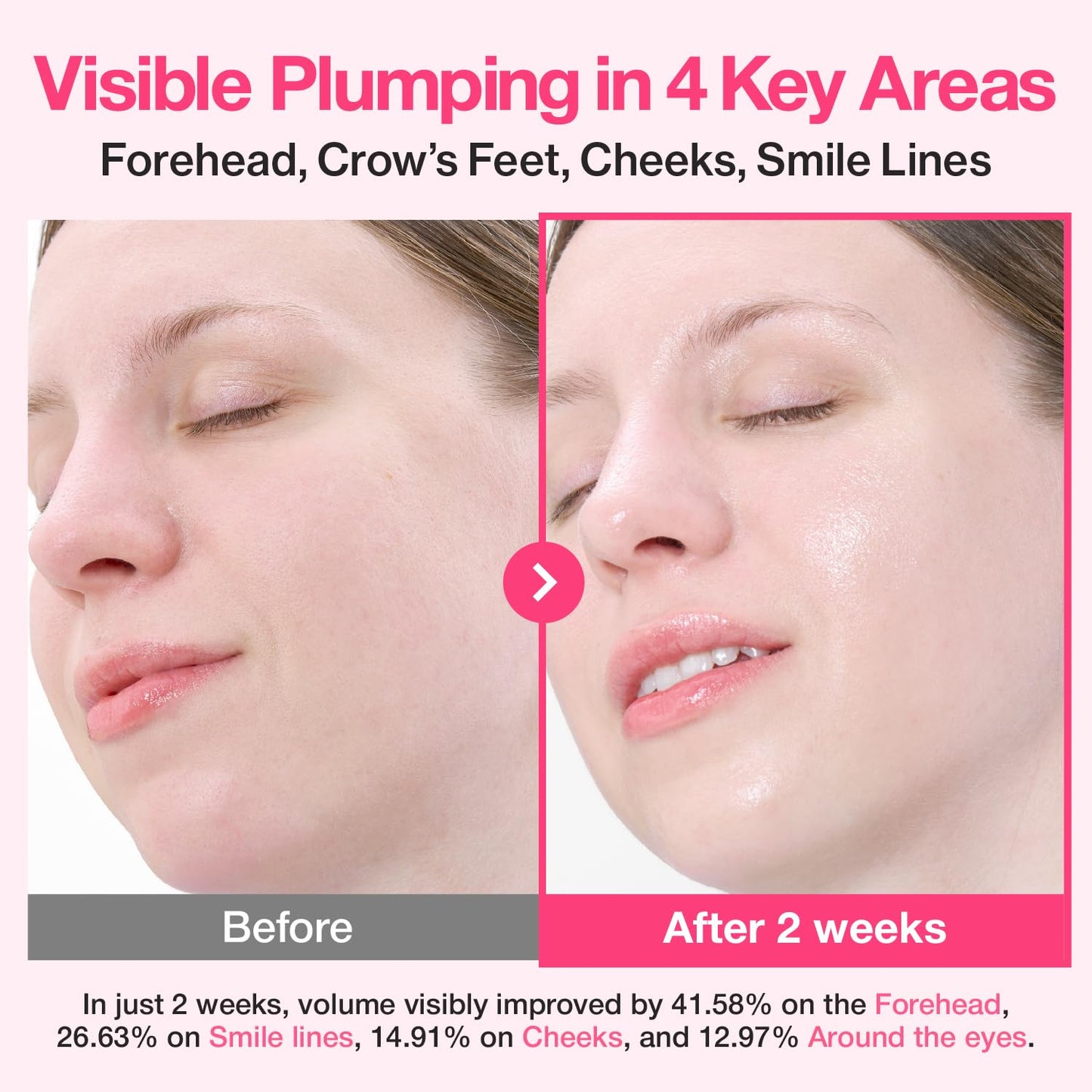 numbuzin - No.2 Rose PDRN Collagen Plumping Serum