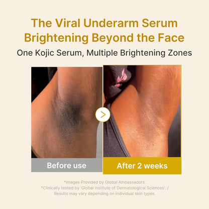 medicube - Kojic Acid Turmeric Niacinamide Serum