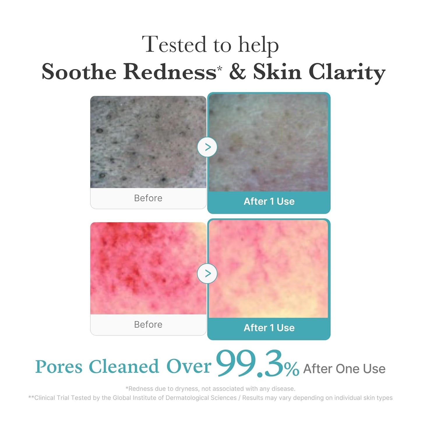medicube - Azelaic Acid Niacinamide Deep Clean Foam Cleanser