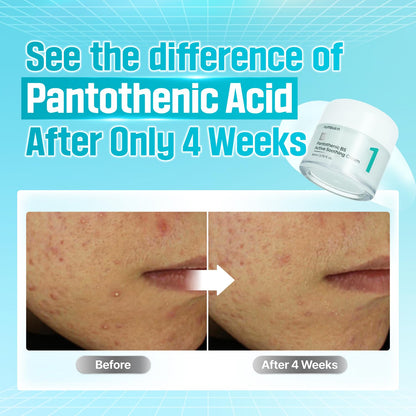 numbuzin - No.1 Pantothenic B5 Active Soothing Cream - Crème apaisante