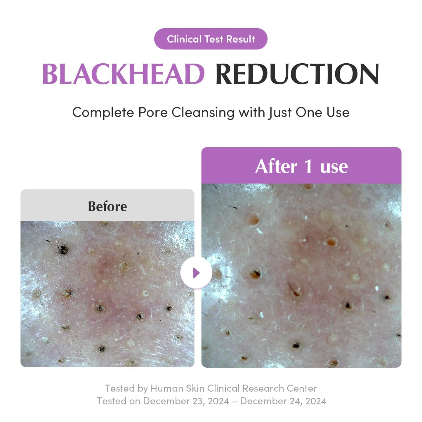 EQQUALBERRY - Purple Rice Pore Purifying Pack Cleanser