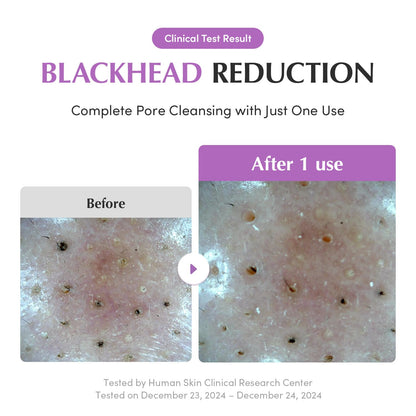 EQQUALBERRY - Purple Rice Pore Purifying Pack Cleanser