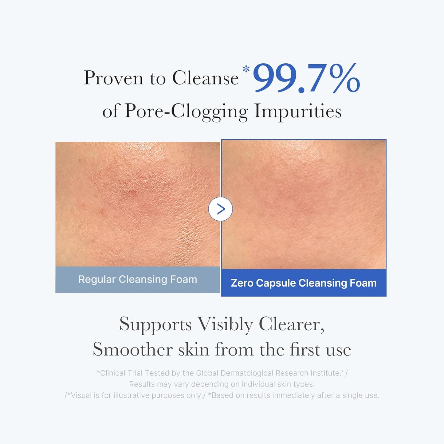 medicube - Zero Pore SA Clear Capsule Cleansing Foam