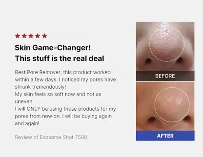medicube - One Day Exosome Shot Pore Ampoule 7500 30ml